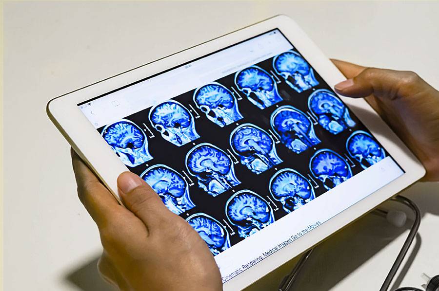 A person holding a tablet displaying multiple blue brain MRI scans.